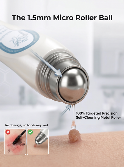 DermaErase™ – Precision Roll-On for Warts, Skin Tags & Blemishes