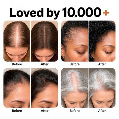 Follicare™ – Get Fuller, Stronger, and Healthier Hair with an Effective Hair Growth Serum