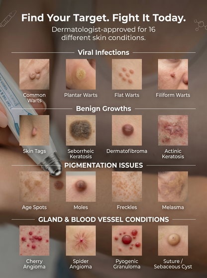 DermaErase™ – Precision Roll-On for Warts, Skin Tags & Blemishes
